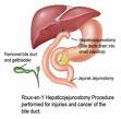 Gallbladder